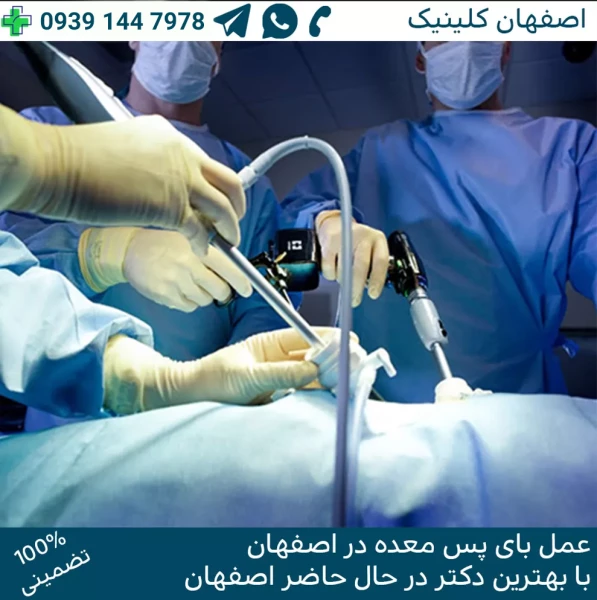 عمل بای پس معده در اصفهان عمل بای پس معده در اصفهان