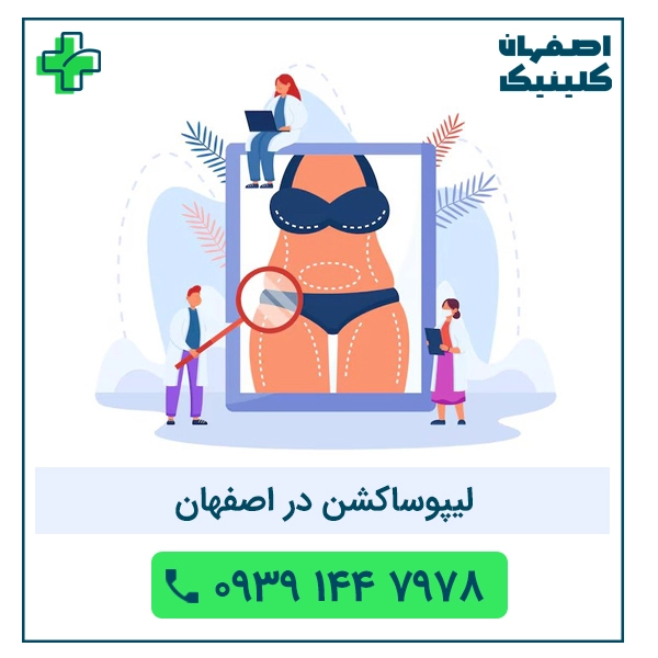 لیپوساکشن در اصفهان