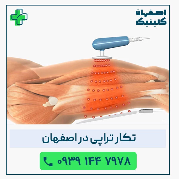 تکار تراپی دراصفهان