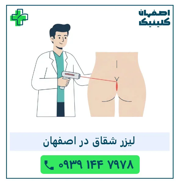 لیزر شقاق در اصفهان